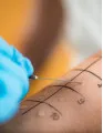 Allergy Diagnostics Market by Product, End-user, and Geography - Forecast and Analysis 2021-2025