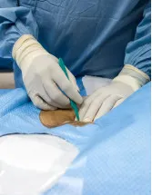 Surgical Drapes Market by Type and Geography - Forecast and Analysis 2021-2025