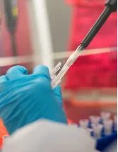 Immunodiagnostics Market by Product, Application, and Geography - Forecast and Analysis 2023-2027