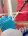 Immunodiagnostics Market by Product, Application, and Geography - Forecast and Analysis 2023-2027