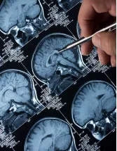 Epilepsy Therapeutics Market in APAC by Product and Geography - Forecast and Analysis 2021-2025