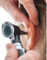 ENT Laser Devices Market by Product and Geography - Forecast and Analysis 2021-2025