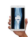 Joint Reconstruction Devices Market by Product and Geography - Forecast and Analysis 2021-2025