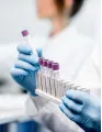 Protein Expression Market by Solution, End-user, and Geography - Forecast and Analysis 2023-2027