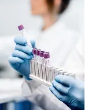 Protein Expression Market Analysis North America,Europe,Asia,Rest of World (ROW) - US,UK,Germany,China,Japan - Size and Forecast 2023-2027