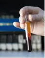 Coagulation Testing Market by Product, Application, Technology, End-user, and Geography - Forecast and Analysis 2021-2025