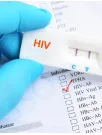 Human Immunodeficiency Virus Rapid Test Kits Market Analysis North America,Europe,Asia,Rest of World (ROW) - US,Canada,UK,Germany,China - Size and Forecast 2024-2028