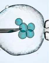 IVF Devices and Consumables Market by Product and Geography - Forecast and Analysis 2022-2026