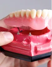 Dentures Market by Product, End-user, Material, and Geography - Forecast and Analysis 2023-2027