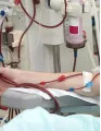 Blood Pressure (BP) Transducers Market by Product, End-user and Geography - Forecast and Analysis 2023-2027