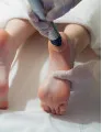 Ortho Pediatric Devices Market by Product and Geography - Forecast and Analysis 2022-2026