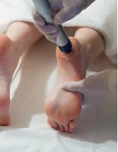 Ortho Pediatric Devices Market by Application, Product and Geography - Forecast and Analysis 2023-2027