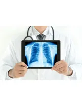 Lung Cancer Liquid Biopsy Market by Product, End-user, and Geography - Forecast and Analysis 2020-2024