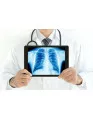 Lung Cancer Liquid Biopsy Market by Product, End-user, and Geography - Forecast and Analysis 2020-2024