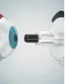 Ophthalmic Femtosecond Lasers Market by Product and Geography - Forecast and Analysis 2022-2026