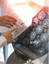 Radiation Oncology Market by Type, Application and Geography - Forecast and Analysis 2023-2027