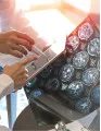Radiation Oncology Market by Type, Application and Geography - Forecast and Analysis 2023-2027