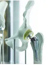 Orthopedic Surgical Robots Market by Application, End-user, and Geography - Forecast and Analysis 2023-2027