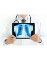 Advanced X-Ray Visualization Systems Market by Product and Geography - Forecast and Analysis 2020-2024