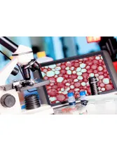 Prostate Biopsy Market by Product, End-user, and Geography - Forecast and Analysis 2020-2024