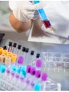 Clinical Laboratory Services Market by End-user, Application, and Geography - Forecast and Analysis 2023-2027
