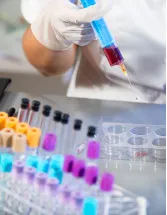 Clinical Laboratory Services Market by End-user, Application, and Geography - Forecast and Analysis 2023-2027