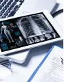 Endoscopic Mucosal Resection Devices Market by End-user, Product and Geography - Forecast and Analysis 2023-2027