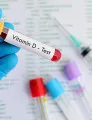 Vitamin D Testing Market by Product, End-user and Geography - Forecast and Analysis 2023-2027