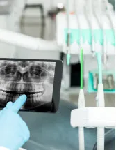 Dental Radiology Equipment Market by Product, End-user, and Geography - Forecast and Analysis 2023-2027