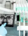 Dental Radiology Equipment Market by Product, End-user, and Geography - Forecast and Analysis 2023-2027