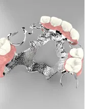 Dental Adhesives Market by Product, End-user, and Geography - Forecast and Analysis 2022-2026