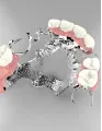 Dental Adhesives Market by Product, End-user, and Geography - Forecast and Analysis 2022-2026