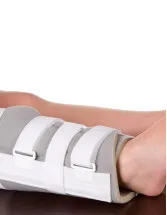 Fracture Fixation Products Market by Product, Application, and Geography - Forecast and Analysis 2023-2027