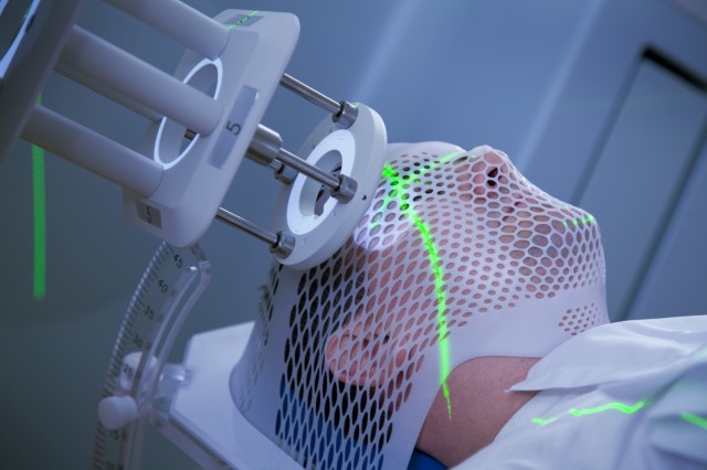 Kaposi Sarcoma Market by Treatment Type and Geography - Forecast and Analysis 2021-2025