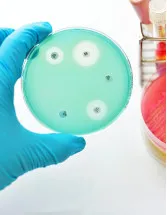 Methicillin-Resistant Staphylococcus Aureus (MRSA) Testing Market by End-user, Type and Geography - Forecast and Analysis 2023-2027