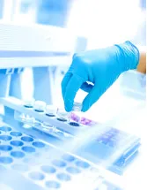 Clinical Reference Laboratory Services Market by End-user, Service, Application, and Geography - Forecast and Analysis 2021-2025