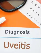 Uveitis Drugs Market by Product and Geography - Forecast and Analysis 2022-2026