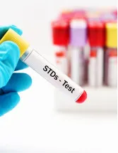Sexually Transmitted Disease (STD) Testing Market by Disease Type, Product and Geography - Forecast and Analysis 2023-2027