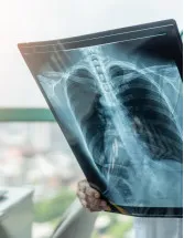Chronic Obstructive Pulmonary Disease Drugs Market by Product, Distribution Channel and Geography - Forecast and Analysis 2023-2027