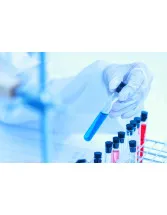 Drug Discovery Outsourcing Market by Product and Geography - Forecast and Analysis 2021-2025