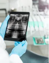 Dental Practice Management Software Market Analysis North America, Europe, APAC, Middle East and Africa, South America - US, China, Japan, Germany, UK - Size and Forecast 2024-2028