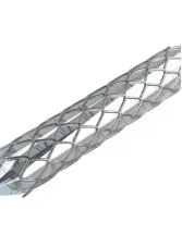 Gastrointestinal Stents Market by Product, End-user, and Geography - Forecast and Analysis 2021-2025