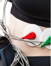 Mobile Cardiac Telemetry Systems Market by Technology and Geography - Forecast and Analysis 2021-2025