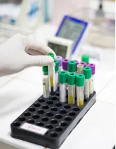 In-vitro Diagnostics (IVD) Market Analysis North America, Europe, Asia, Rest of World (ROW) - US, Canada, Germany, China, Japan - Size and Forecast 2024-2028