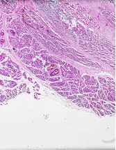Bone Biopsy Market by Type, End-user, and Geography - Forecast and Analysis 2023-2027