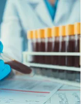 Vacuum Blood Collection Tube Market by Product and Geography - Forecast and Analysis 2022-2026