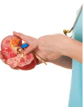Kidney Stones Therapeutic Market by Type, End-user, and Geography - Forecast and Analysis 2023-2027