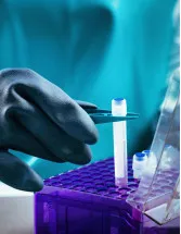 Stem Cell Banking Market by Type and Geography - Forecast and Analysis 2021-2025