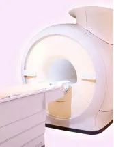 Magnetic Resonance Imaging (MRI) Coils Market by Type, End-user, and Geography - Forecast and Analysis 2023-2027