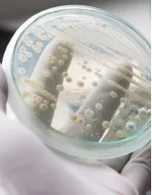 Prils Market by Application and Geography - Forecast and Analysis 2022-2026